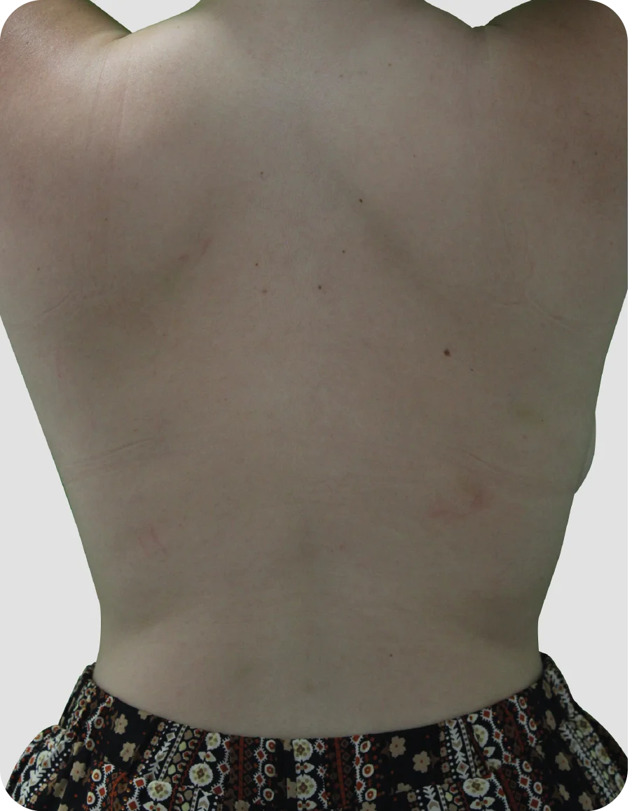 B_A_patient 21_after