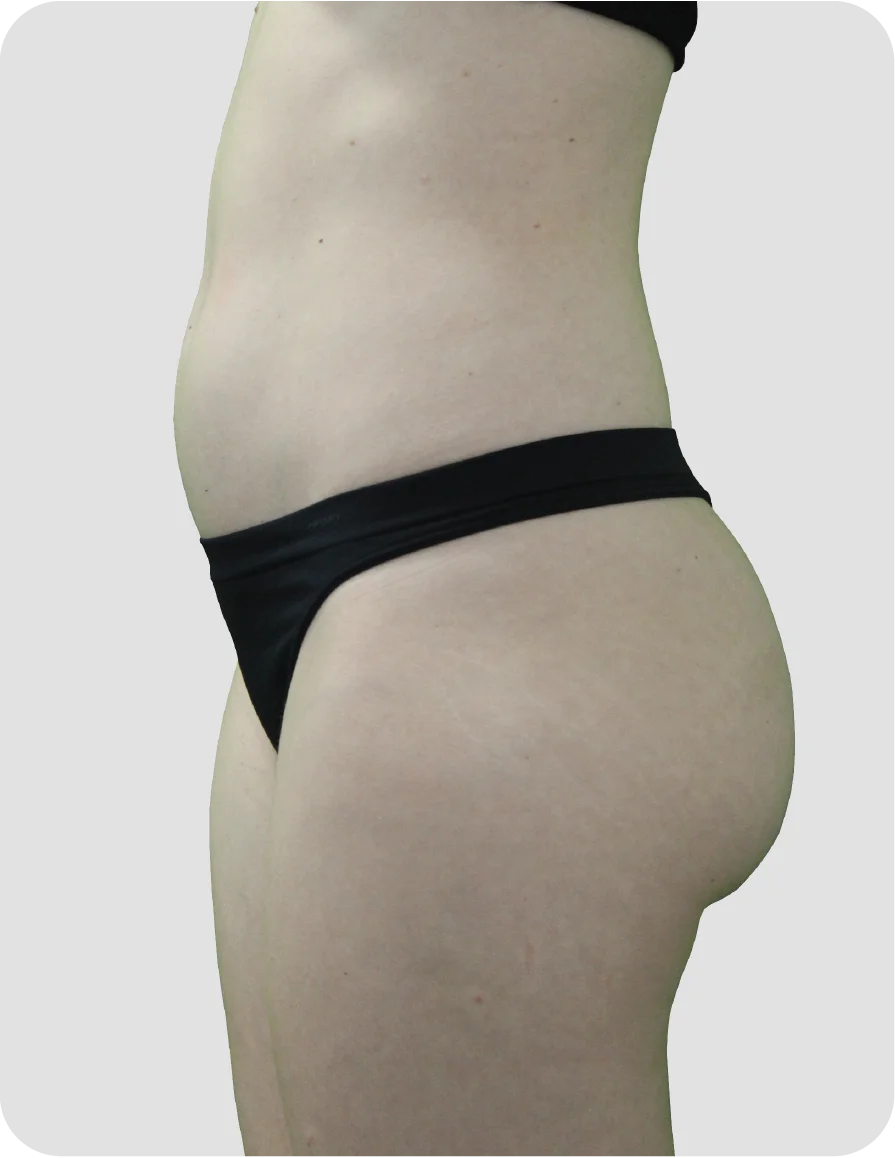 B_A_patient 22_before