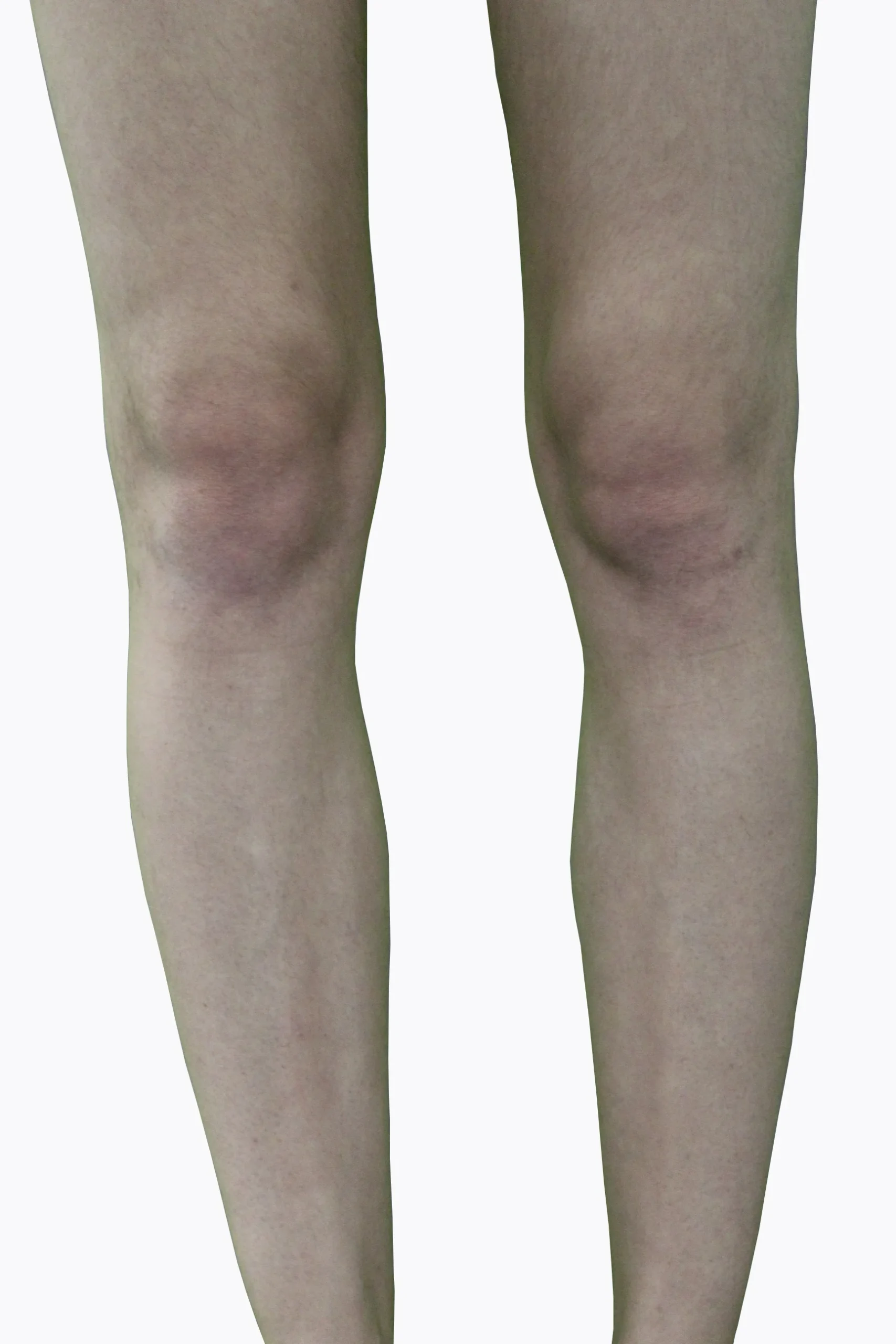 Legs_After (5)