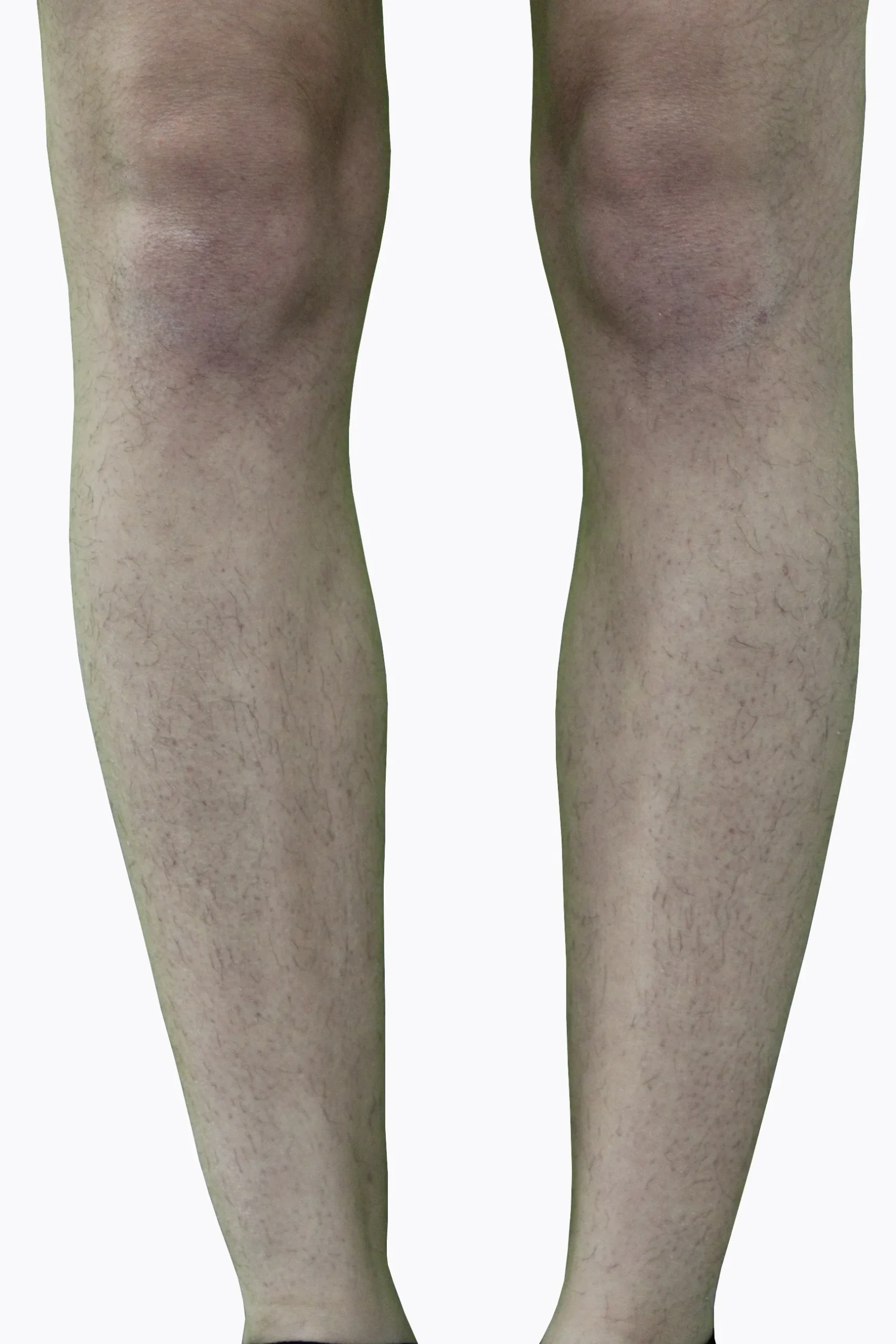 Legs_Before (5)