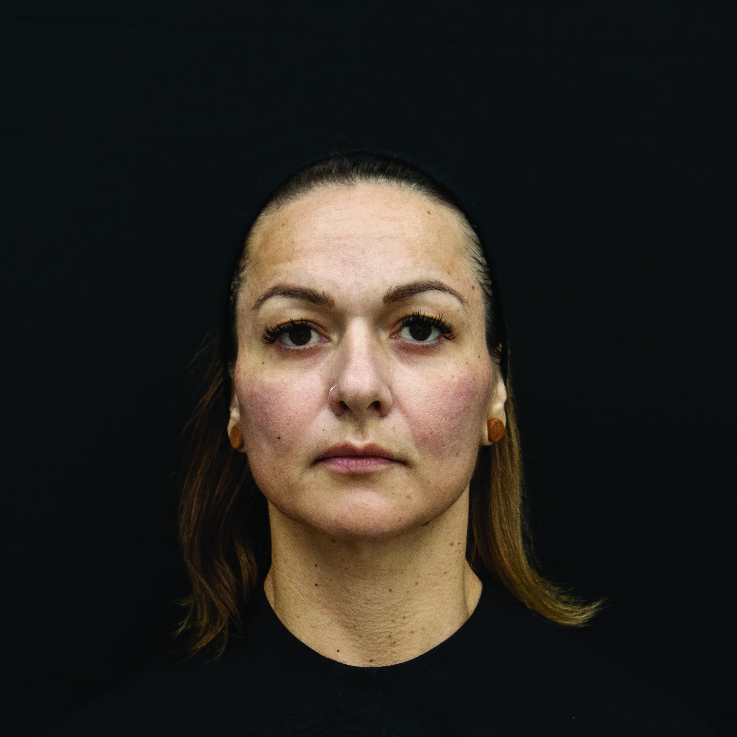 Viviane before RT
