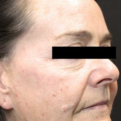 tribella_en_2_before_2