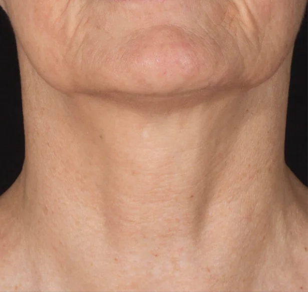 после (1) после (1)