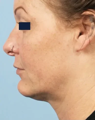 matrixafter1 matrixafter1