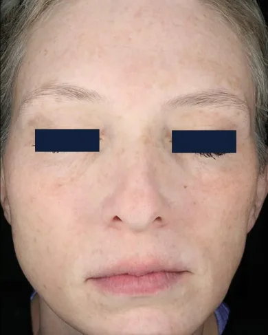 matrixafter2 matrixafter2