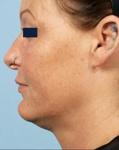 matrixbefore1 matrixbefore1