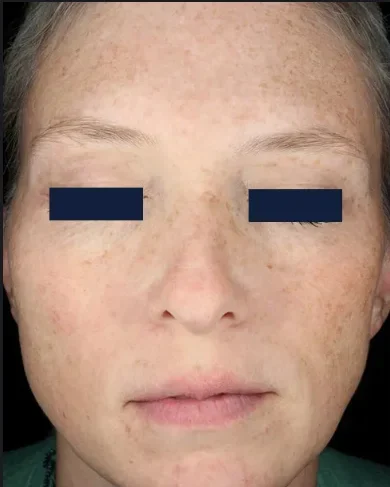 matrixbefore2 matrixbefore2