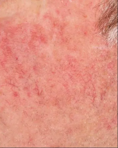 perfecta_after1 perfecta_after1