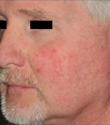 perfecta_after3 perfecta_after3