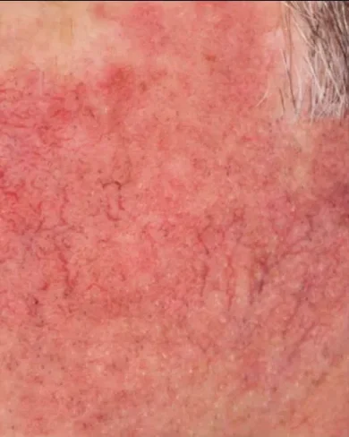 perfecta_before1 perfecta_before1