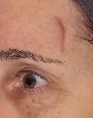 perfecta_before2 perfecta_before2