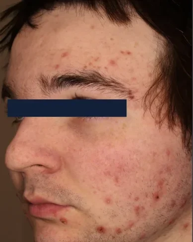 perfecta_before4 perfecta_before4